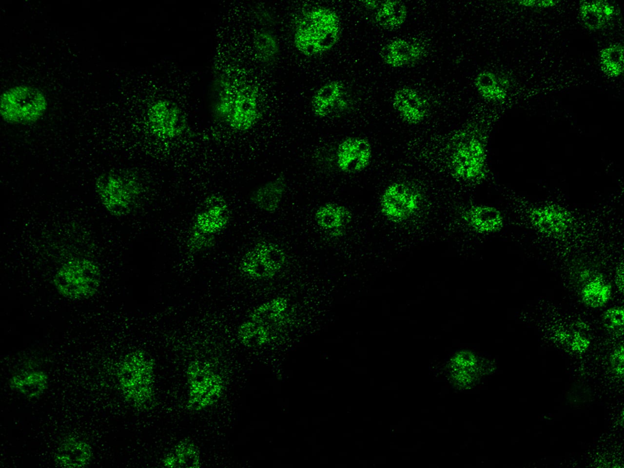 Immunocytochemistry/Immunofluorescence: IRF6 Antibody [NBP2-98729] - Immunofluorescence staining of IRF6 in COS7 cells. Cells were fixed with 4% PFA, permeabilzed with 0.3% Triton X-100 in PBS, blocked with 10% serum, and incubated with NBP2-98729 antibody (1:1000) at 4C overnight. Then cells were stained with the Alexa Fluor(R)488-conjugated Goat Anti-rabbit IgG Secondary antibody (green).Positive staining was localized to cytoplasm and nucleus.