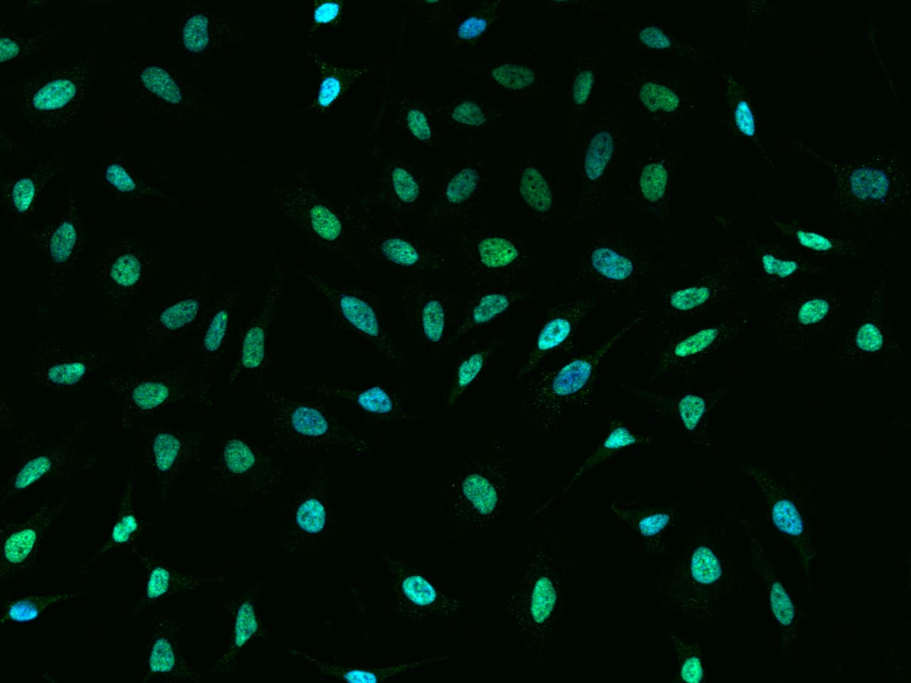 Immunocytochemistry/Immunofluorescence: CBX1 Antibody [NBP2-98756] - Immunofluorescence staining of CBX1 in HeLa cells. Cells were fixed with 4% PFA, permeabilzed with 0.1% Triton X-100 in PBS, blocked with 10% serum, and incubated with NBP2-98756 antibody (dilution ratio 1:1000) at 4C overnight. Then cells were stained with the Alexa Fluor(R)488-conjugated Goat Anti-rabbit IgG Secondary antibody (green) and counterstained with DAPI (blue).Positive staining was localized to Nucleus .