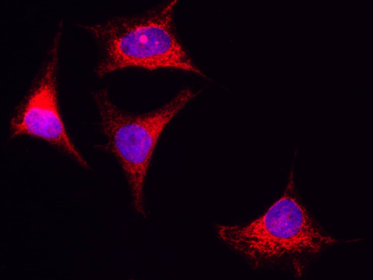Immunocytochemistry/Immunofluorescence: PIK3CA Antibody [NBP2-98814] - Immunofluorescence staining of PIK3CA in HeLa cells. Cells were fixed with 4% PFA, permeabilzed with 0.3% Triton X-100 in PBS, blocked with 10% serum, and incubated with NBP2-98814 antibody (1:5000) at 4C overnight. Then cells were stained with the Alexa Fluor(R)594-conjugated Goat Anti-rabbit IgG secondary antibody (red) and counterstained with DAPI (blue). Positive staining was localized to cytoplasm.