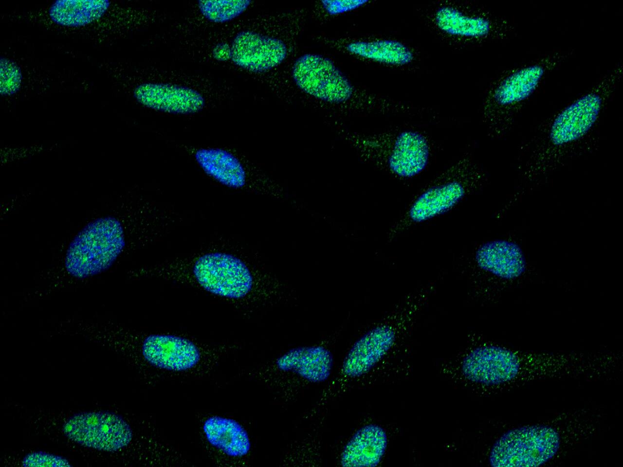 Immunocytochemistry/Immunofluorescence: TLK1 Antibody [NBP2-98826] - Immunofluorescence staining of TLK1 in Hela cells. Cells were fixed with 4% PFA, blocked with 10% serum, and incubated with NBP2-98826 antibody (1:1000) at 4C overnight. Then cells were stained with the Alexa Fluor(R)488-conjugated Goat Anti-rabbit IgG secondary antibody (green) and counterstained with DAPI (blue). Positive staining was localized to nucleus.