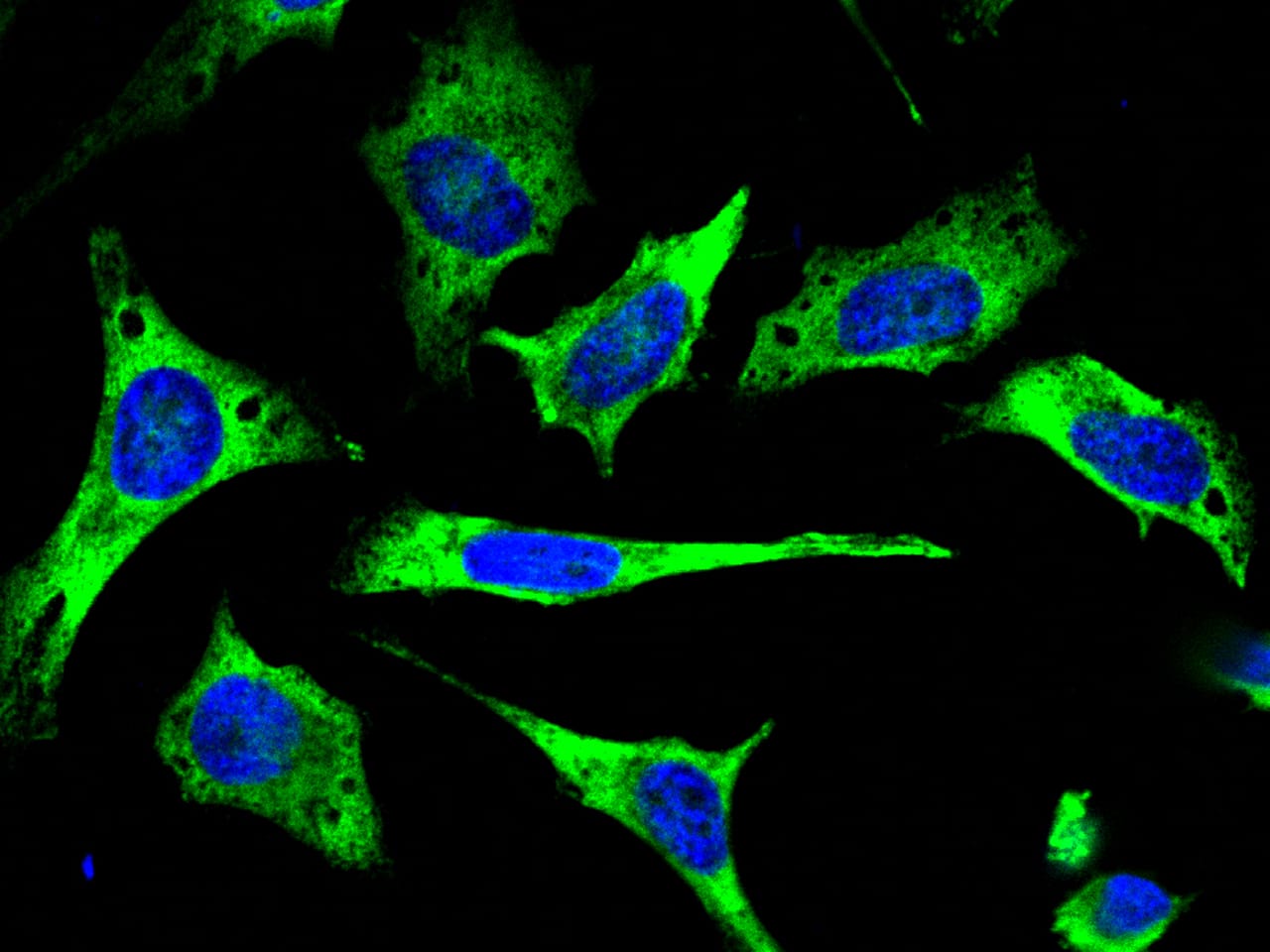 Immunocytochemistry/Immunofluorescence: TTK Antibody [NBP2-98832] - Immunofluorescence staining of TTK in HeLa cells. Cells were fixed with 4% PFA, permeabilzed with 0.3% Triton X-100 in PBS, blocked with 10% serum, and incubated with NBP2-98832 antibody (1:1000) at 4C overnight. Then cells were stained with the Alexa Fluor(R)488-conjugated Goat Anti-rabbit IgG secondary antibody (green) and counterstained with DAPI (blue). Positive staining was localized to cytoplasm.