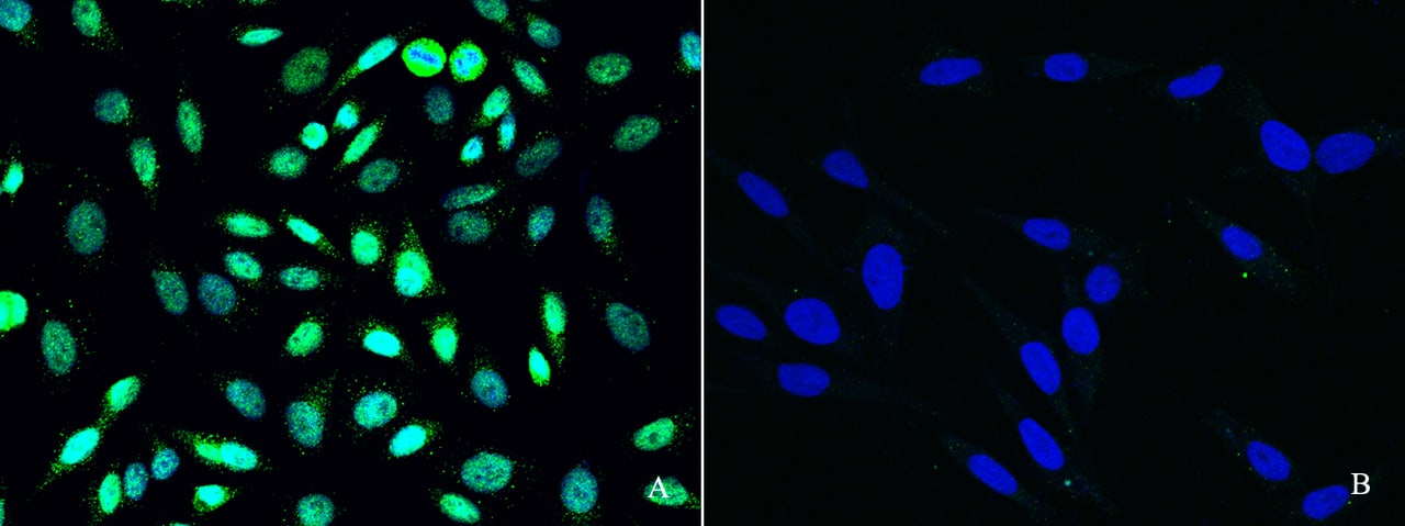 Immunocytochemistry/Immunofluorescence: PRMT6 Antibody [NBP2-98847] - Immunofluorescence staining of PRMT6 in HeLa cells. Cells were fixed with 4% PFA, blocked with 10% serum. Then incubated with NBP2-98847 antibody (1:1000)(Figure A), incubated with NBP2-98847 antibody and antigen (Figure B) at 4C overnight. Then cells were stained with the Alexa Fluor(R)488-conjugated Goat Anti-rabbit IgG secondary antibody (green) and counterstained with DAPI (blue). Positive staining was localized to nucleus.
