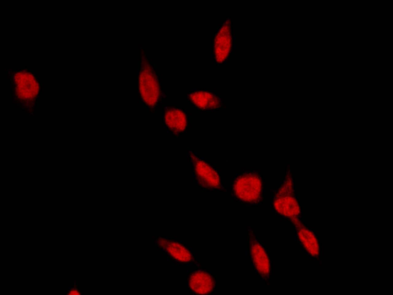 Immunocytochemistry/Immunofluorescence: RAD18 Antibody [NBP2-98850] - Immunofluorescence staining of RAD18 in Hela cells. Cells were fixed with 4% PFA, permeabilzed with 0.3% Triton X-100 in PBS, blocked with 10% serum, and incubated with NBP2-98850 antibody (1:1000) at 4C overnight. Then cells were stained with the Alexa Fluor(R)594-conjugated Goat Anti-rabbit IgG secondary antibody (red). Positive staining was localized to nucleus.