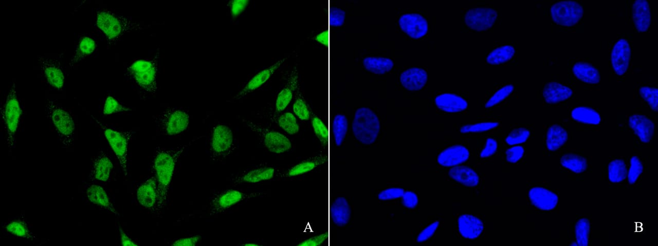 Immunocytochemistry/Immunofluorescence: PDCD4 Antibody [NBP2-98857] - Immunofluorescence staining of PDCD4 in HeLa cells. Cells were fixed with 4% PFA, blocked with 10% serum. Then incubated with NBP2-98857 antibody (1:1000)(Figure A), incubated with NBP2-98857 antibody and antigen (Figure B) at 4C overnight. Then cells were stained with the Alexa Fluor(R)488-conjugated Goat Anti-rabbit IgG secondary antibody (green) and counterstained with DAPI (blue). Positive staining was localized to nucleus.