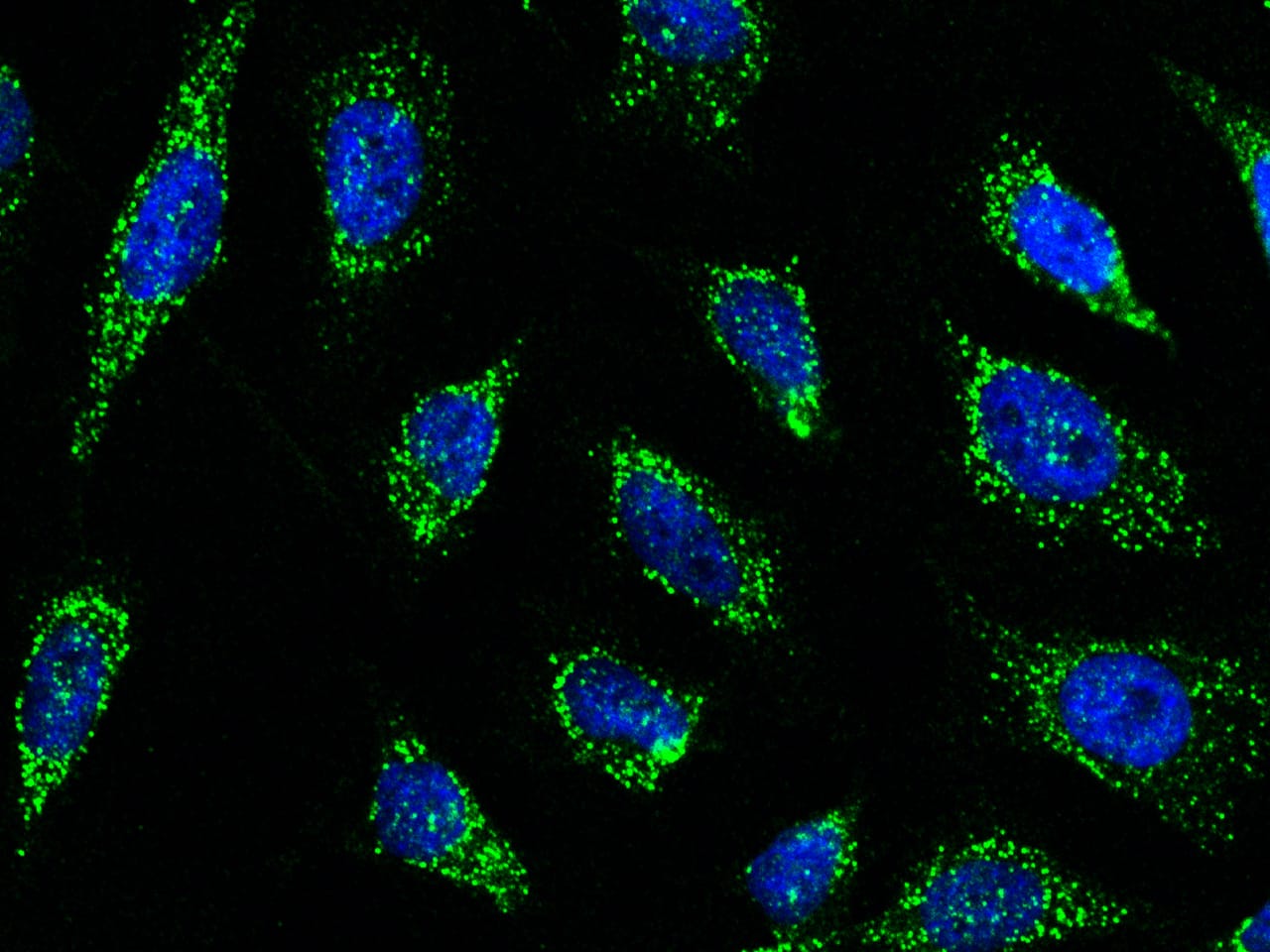 Immunocytochemistry/Immunofluorescence: Smad9 Antibody [NBP2-98884] - Immunofluorescence staining of Smad9 in Hela cells. Cells were fixed with 4% PFA, permeabilzed with 0.3% Triton X-100 in PBS, blocked with 10% serum, and incubated with NBP2-98884 antibody (1:5000) at 4C overnight. Then cells were stained with the Alexa Fluor(R)488-conjugated Goat Anti-rabbit IgG secondary antibody (green) and counterstained with DAPI (blue). Positive staining was localized to cytoplasm.