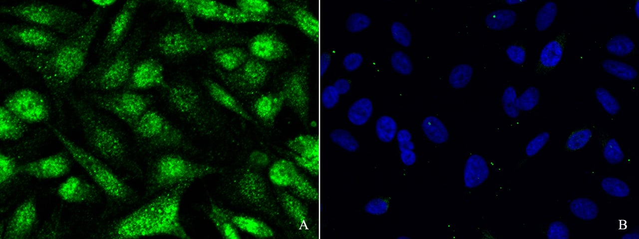 Immunocytochemistry/Immunofluorescence: SOCS-1 Antibody [NBP2-98891] - Immunofluorescence staining of SOCS-1 in HeLa cells. Cells were fixed with 4% PFA, blocked with 10% serum. Then incubated with NBP2-98891 antibody (1:1000)(Figure A), incubated with NBP2-98891 antibody and antigen (Figure B) at 4C overnight. Then cells were stained with the Alexa Fluor(R)488-conjugated Goat Anti-rabbit IgG secondary antibody (green) and counterstained with DAPI (blue). Positive staining was localized to cytoplasm and nucleus.