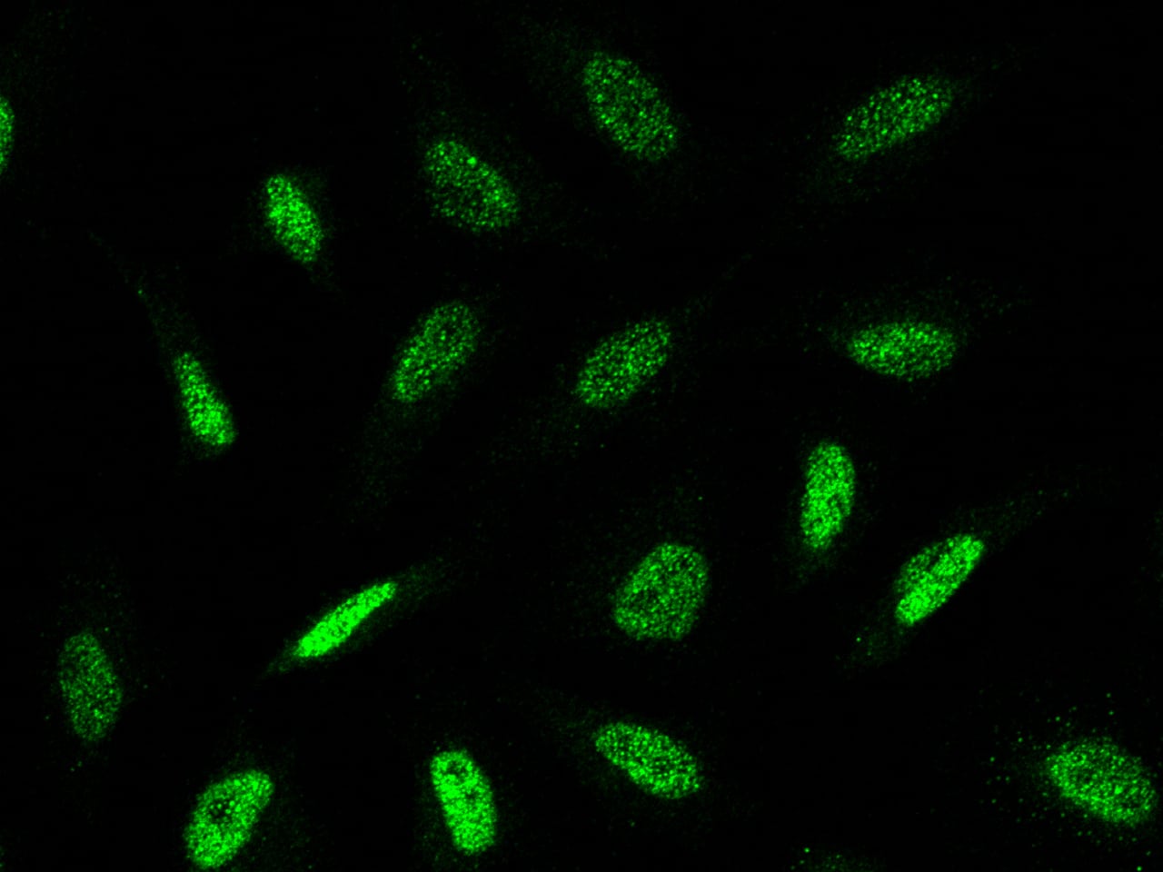Immunocytochemistry/Immunofluorescence: TLE1 Antibody [NBP2-98893] - Immunofluorescence staining of TLE1 in HeLa cells. Cells were fixed with 4% PFA, permeabilzed with 0.3% Triton X-100 in PBS, blocked with 10% serum, and incubated with NBP2-98893 antibody (1:5000) at 4C overnight. Then cells were stained with the Alexa Fluor(R)488-conjugated Goat Anti-rabbit IgG secondary antibody (green).Positive staining was localized to nucleus.