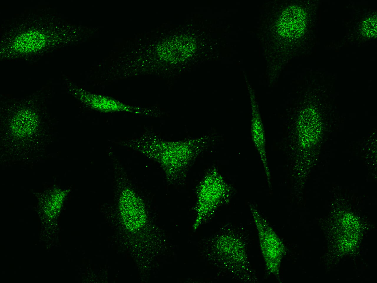 Immunocytochemistry/Immunofluorescence: Cofilin 2 Antibody [NBP2-98910] - Immunofluorescence staining of Cofilin 2 in HeLa cells. Cells were fixed with 4% PFA, permeabilzed with 0.3% Triton X-100 in PBS, blocked with 10% serum, and incubated with NBP2-98910 antibody (1:1000) at 4C overnight. Then cells were stained with the Alexa Fluor(R)488-conjugated Goat Anti-rabbit IgG Secondary antibody (green).Positive staining was localized to cytoplasm and nucleus.