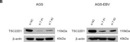 Functional impact of TSC22D1 knockdown in gastric cancer cells. qRT-PCR (A) and Western blot (B) analyses were performed to assess TSC22D1 expression levels following siRNA-mediated TSC22D1 knockdown in AGS and AGS-EBV cells. MTT assay (C) and colony formation assay (D) were conducted to assess the impact of TSC22D1 knockdown on cell proliferation and oncogenicity. Both experiments were independently performed three times, and representative results are shown in (C,D). (E) Wound healing assay was performed to assess the effect of TSC22D1 knockdown on cell migration in AGS and AGS-EBV cells. (F) Flow cytometry analysis using Annexin V/7-AAD staining was conducted to evaluate apoptosis following TSC22D1 knockdown in AGS and AGS-EBV cells. p-values: * p < 0.05; ** p < 0.01; *** p < 0.001; **** p < 0.0001. Image collected and cropped by CiteAb from the following open publication (//pubmed.ncbi.nlm.nih.gov/41472023), licensed under a CC-BY license. Not internally tested by Novus Biologicals.