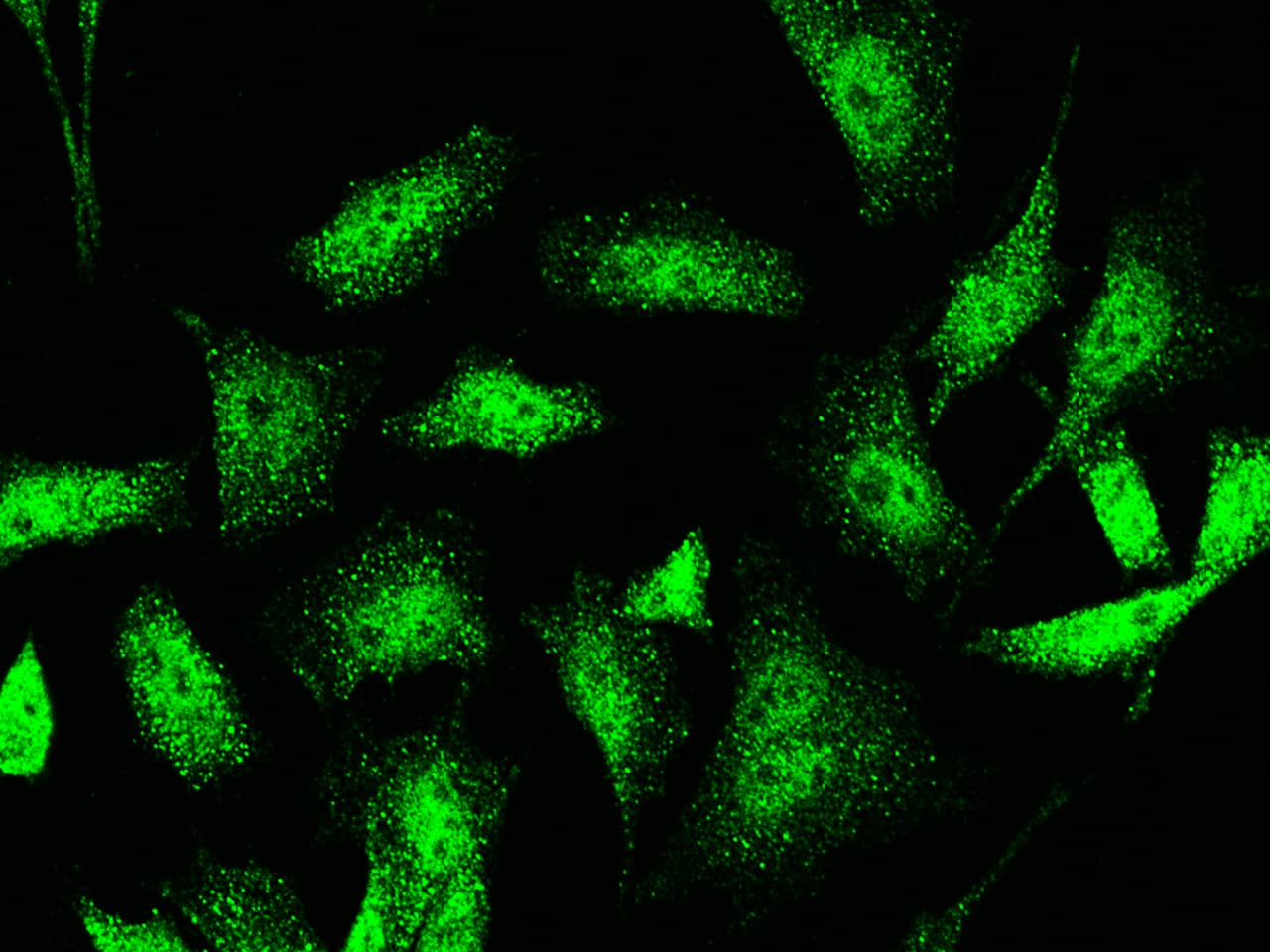 Immunocytochemistry/Immunofluorescence: Jade-1/PHF17 Antibody [NBP2-98965] - Immunofluorescence staining of Jade-1/PHF17 in HeLa cells. Cells were fixed with 4% PFA, blocked with 10% serum, and incubated with NBP2-98965 antibody (1:1000) at 4C overnight. Then cells were stained with the Alexa Fluor(R)488-conjugated Goat Anti-rabbit IgG Secondary antibody (green).Positive staining was localized to cytoplasm and nucleus.