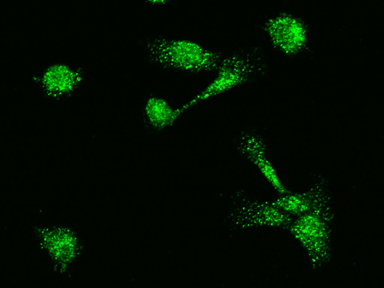 Immunocytochemistry/Immunofluorescence: MBD3L1 Antibody [NBP2-99004] - Immunofluorescence staining of MBD3L1 in A431 cells. Cells were fixed with 4% PFA, permeabilzed with 0.3% Triton X-100 in PBS, blocked with 10% serum, and incubated with NBP2-99004 antibody (1:1000) at 4C overnight. Then cells were stained with the Alexa Fluor(R)488-conjugated Goat Anti-rabbit IgG secondary antibody (green).Positive staining was localized to cytoplasm and nucleus.