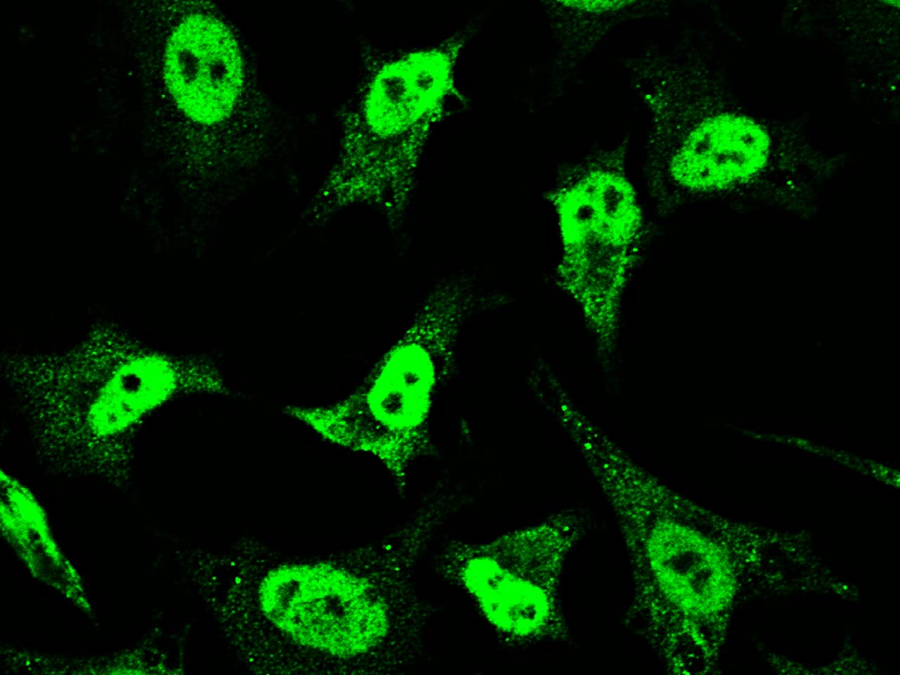 Immunocytochemistry/Immunofluorescence: Mineralocorticoid R/NR3C2 Antibody [NBP2-99010] - Staining of NR3C2 in HeLa cells. Cells were fixed with 4% PFA, permeabilzed with 0.3% Triton X-100 in PBS,blocked with 10% serum, and incubated with NBP2-99010 antibody (1:1000) at 4? overnight. Then cells were stained with the Alexa Fluor488-conjugated Goat Anti-rabbit IgG secondary antibody (green).Positive staining was localized to cytoplasm and nucleus.
