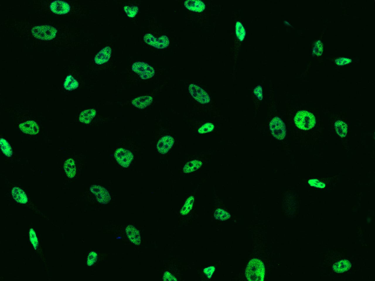 Immunocytochemistry/Immunofluorescence: TCF-12/HTF4 Antibody [NBP2-99046] - Immunofluorescence staining of TCF-12/HTF4 in HeLa cells. Cells were fixed with 4% PFA, permeabilzed with 0.1% Triton X-100 in PBS, blocked with 10% serum, and incubated with NBP2-99046 antibody (dilution ratio 1:1000) at 4C overnight. Then cells were stained with the Alexa Fluor(R)488-conjugated Goat Anti-rabbit IgG secondary antibody (green). Positive staining was localized to .
