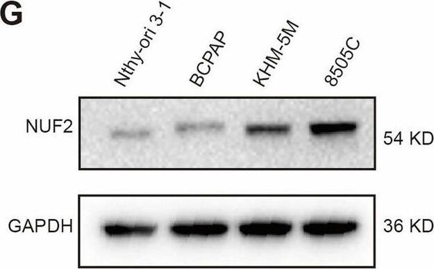 Expression of NUF2 in ATC and clinical relevance.A The relevance of NUF2 expression and relapse-free survival (RFS) in patients with thyroid cancer (TC). B Expression of NUF2 in TC subgroups based on nodal metastasis status. C The expression of NUF2 in NT, PTC, PDTC, and ATC based on four microarray datasets from GEO database. D, E IHC staining of NUF2 in NT and ATC tissues. F–H The mRNA and protein levels of NUF2 in different thyroid cancer cell lines. I, J The expression of NUF2 in cytoplasm and nucleus. K The expression of NUF2 in different cell cycle phases. Data are presented as the mean +/- SD. *P < 0.05, **P < 0.01, ***P < 0.001. Image collected and cropped by CiteAb from the following open publication (//pubmed.ncbi.nlm.nih.gov/39242581), licensed under a CC-BY license. Not internally tested by Novus Biologicals.