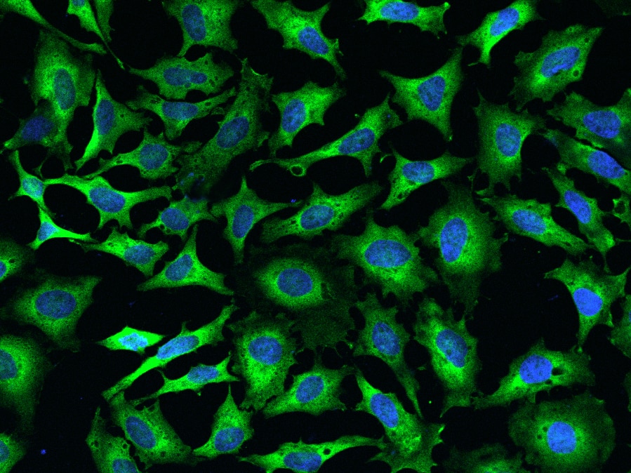 Immunocytochemistry/Immunofluorescence: EMAP-II/AIMP1 Antibody [NBP2-99128] - Immunofluorescence staining of EMAP-II/AIMP1 in HeLa cells. Cells were fixed with 4% PFA, permeabilzed with 0.1% Triton X-100 in PBS, blocked with 10% serum, and incubated with NBP2-99128 antibody (dilution ratio 1:500) at 4C overnight. Then cells were stained with the Alexa Fluor(R)488-conjugated Goat Anti-rabbit IgG Secondary antibody (green) and counterstained with DAPI (blue).Positive staining was localized to Cytoplasm.