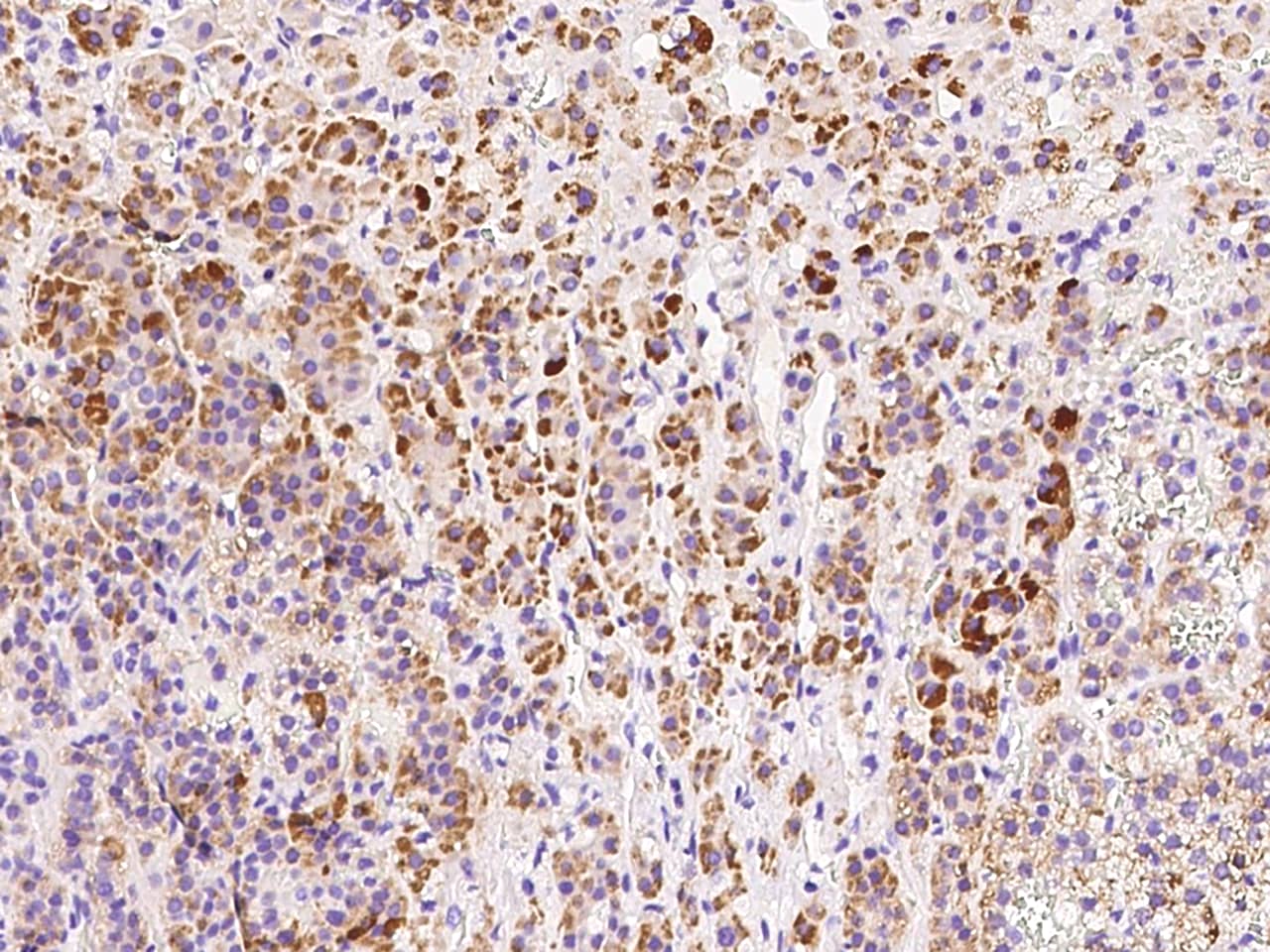 Immunohistochemistry-Paraffin: HDHD3 Antibody - BSA Free [NBP2-99145] - Immunochemical staining of human HDHD3 in human adrenal gland with NBP2-99145 at 1:300 dilution, formalin-fixed paraffin embedded sections.
