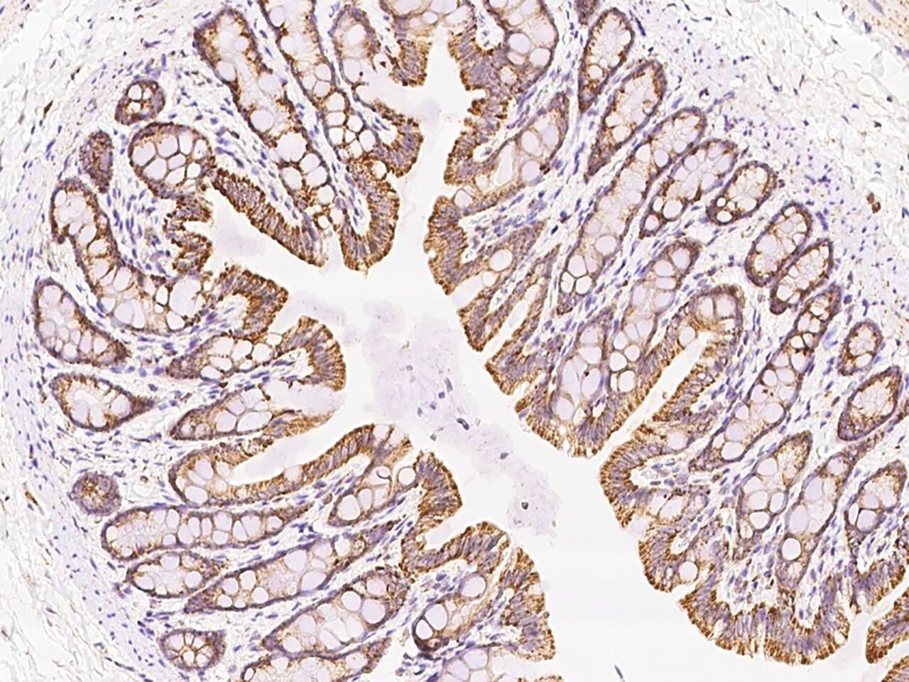 Immunohistochemistry-Paraffin: MCTS1 Antibody [NBP2-99158] - Immunochemical staining of MCTS1 in rat rectum with NBP2-99158 at 1:1000 dilution, formalin-fixed paraffin embedded sections.