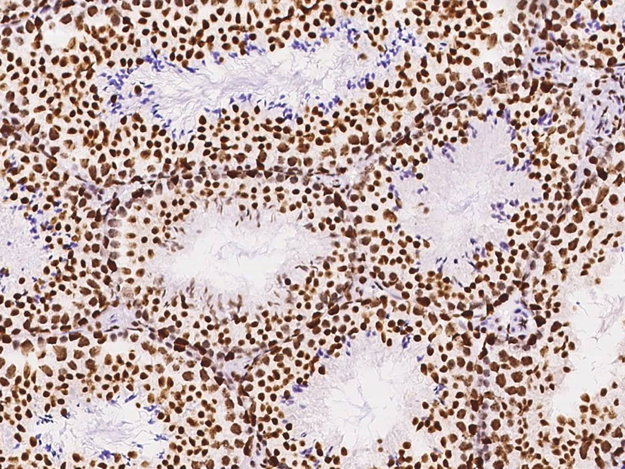 Immunohistochemistry-Paraffin: KLF7 Antibody - BSA Free [NBP2-99217] - Immunochemical staining of KLF7 in mouse testis with NBP2-99217 at 1:300 dilution, formalin-fixed paraffin embedded sections.