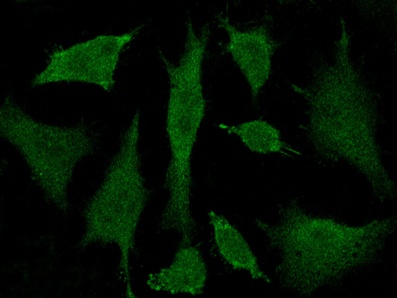 Immunocytochemistry/Immunofluorescence: BRE Antibody [NBP2-99253] - Immunofluorescence staining of BRE in Hela cells. Cells were fixed with 4% PFA, permeabilzed with 0.3% Triton X-100 in PBS, blocked with 10% serum, and incubated with NBP2-99253 antibody (dilution ratio 1:500) at 4C overnight. Then cells were stained with the Alexa Fluor$488-conjugated Goat Anti-rabbit IgG Secondary antibody (green). Positive staining was localized to cytoplasm and nucleus.