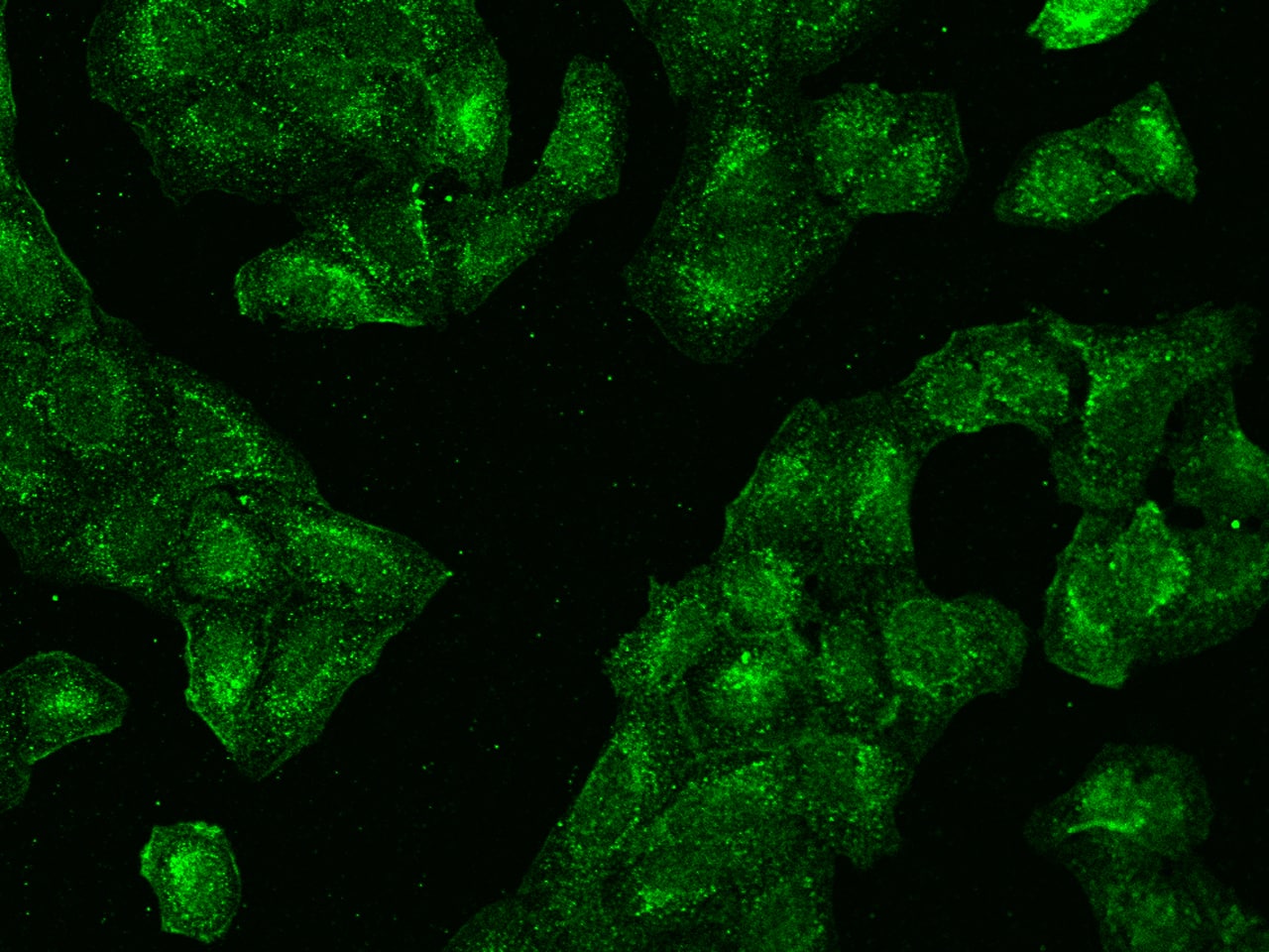 Immunocytochemistry/Immunofluorescence: CCT3 Antibody [NBP2-99266] - Immunofluorescence staining of CCT3 in U2OS cells. Cells were fixed with 4% PFA, permeabilzed with 0.1% Triton X-100 in PBS, blocked with 10% serum, and incubated with NBP2-99266 antibody (dilution ratio 1:500) at 4C overnight. Then cells were stained with the Alexa Fluor(R)488-conjugated Goat Anti-rabbit IgG secondary antibody (green). Positive staining was localized to Cytoplasm.
