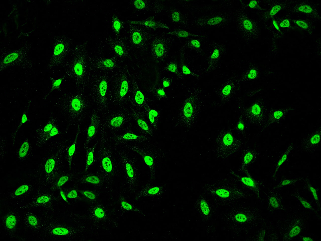 Immunocytochemistry/Immunofluorescence: BAF53A Antibody [NBP2-99367] - Immunofluorescence staining of BAF53A in HeLa cells. Cells were fixed with 4% PFA, permeabilzed with 0.1% Triton X-100 in PBS, blocked with 10% serum, and incubated with NBP2-99367 antibody (dilution ratio 1:1000) at 4C overnight. Then cells were stained with the Alexa Fluor(R)488-conjugated Goat Anti-rabbit IgG Secondary antibody (green). Positive staining was localized to Nucleus .