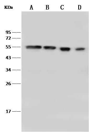 Western Blot: PBX1 Antibody [NBP2-99369] - NBP2-99369 at 1:500 dilution Lane A: MOLT4 Whole Cell Lysate Lane B: Jurkat Whole Cell Lysate Lane C: HeLa Whole Cell Lysate Lane D: K562 Whole Cell Lysate Lysates/proteins at 30 ug per lane. Secondary Goat Anti-Rabbit IgG (H+L)/HRP at 1/10000 dilution. Developed using the ECL technique. Performed under reducing conditions. Predicted band size:47 kDa Observed band size:54 kDa 