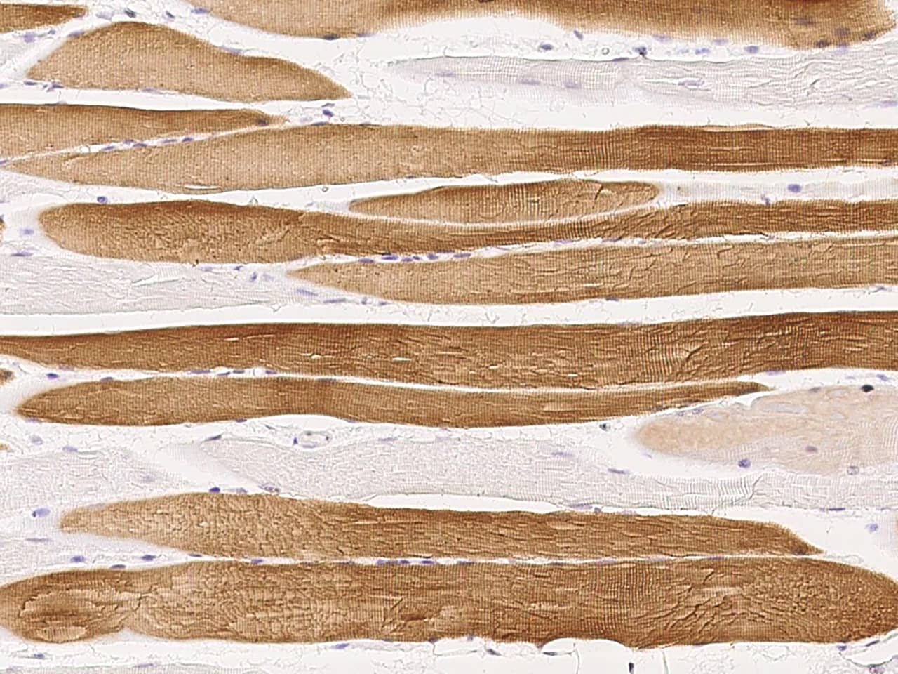 Immunohistochemistry-Paraffin: Troponin C (cardiac) Antibody [NBP2-99393] - Immunochemical staining of Troponin C (cardiac) in human skeletal muscle with NBP2-99393 at 1:1000 dilution, formalin-fixed paraffin embedded sections.