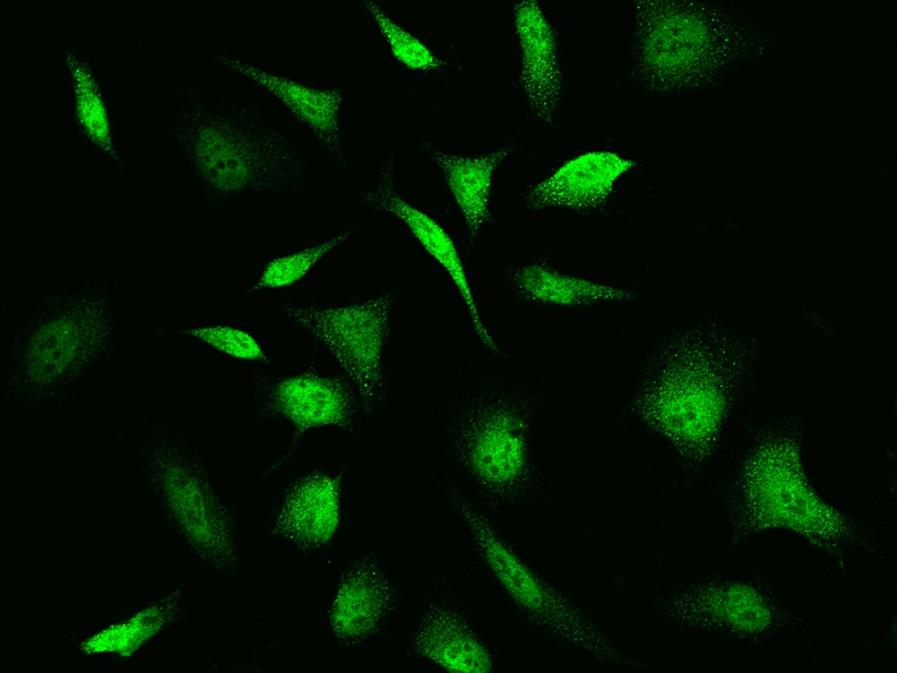 Immunocytochemistry/Immunofluorescence: Troponin C (cardiac) Antibody [NBP2-99393] - Immunofluorescence staining of Troponin C (cardiac) in Hela cells. Cells were fixed with 4% PFA, permeabilzed with 0.1% Triton X-100 in PBS, blocked with 10% serum, and incubated with NBP2-99393 antibody (dilution ratio 1:1000) at 4C overnight. Then cells were stained with the Alexa Fluor(R)488-conjugated Goat Anti-rabbit IgG Secondary antibody (green). Positive staining was localized to cytoplasm and nucleus.