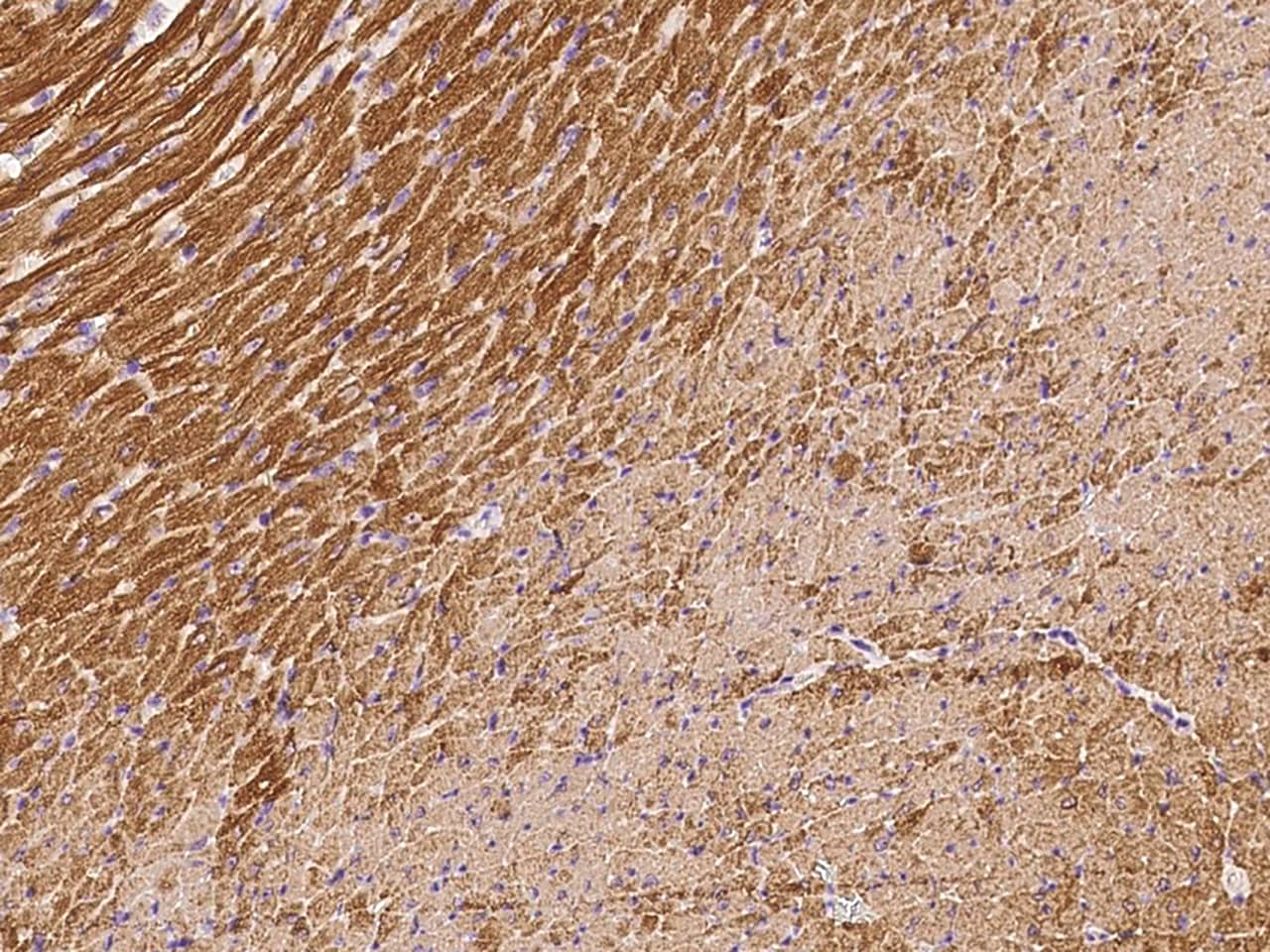 Immunohistochemistry-Paraffin: Troponin C (cardiac) Antibody [NBP2-99435] - Immunochemical staining of Troponin C (cardiac) in mouse heart with NBP2-99435 at 1:1000 dilution, formalin-fixed paraffin embedded sections.