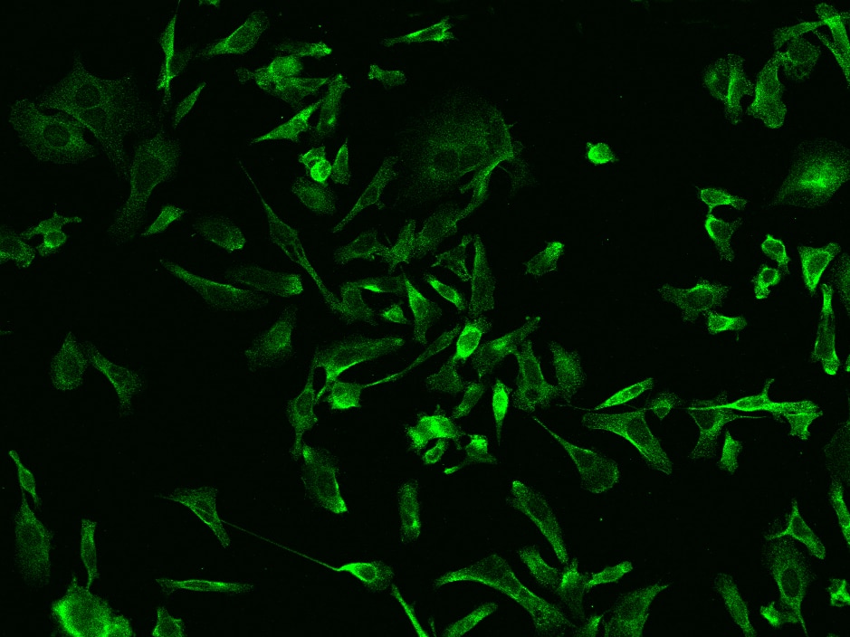 Immunocytochemistry/Immunofluorescence: RIP5 Antibody [NBP2-99509] - Immunofluorescence staining of RIP5 in PC3 cells. Cells were fixed with 4% PFA, permeabilzed with 0.1% Triton X-100 in PBS, blocked with 10% serum, and incubated with NBP2-99509 antibody (dilution ratio 1:200) at 4C overnight. Then cells were stained with the Alexa Fluor(R)488-conjugated Goat Anti-rabbit IgG Secondary antibody (green). Positive staining was localized to Cytoplasm.
