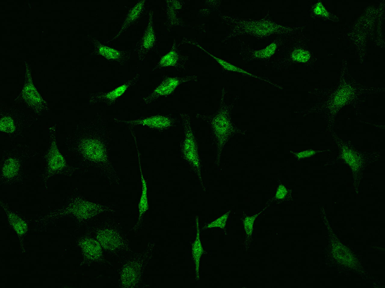 Immunocytochemistry/Immunofluorescence: S100P Antibody [NBP2-99514] - Immunofluorescence staining of S100P in HeLa cells. Cells were fixed with 4% PFA, permeabilzed with 0.1% Triton X-100 in PBS, blocked with 10% serum, and incubated with NBP2-99514 antibody (dilution ratio 1:1000) at 4C overnight. Then cells were stained with the Alexa Fluor(R)488-conjugated Goat Anti-rabbit IgG secondary antibody (green). Positive staining was localized to Nucleus .
