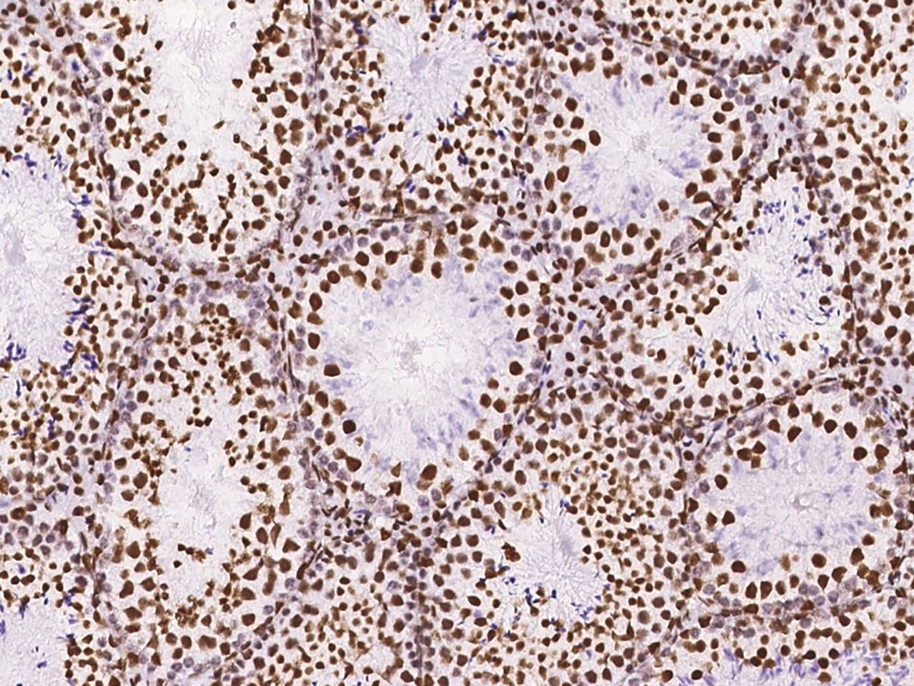 Immunohistochemistry-Paraffin: DZIP1 Antibody - BSA Free [NBP2-99579] - Immunochemical staining of DZIP1 in mouse testis with NBP2-99579 at 1:1000 dilution, formalin-fixed paraffin embedded sections.