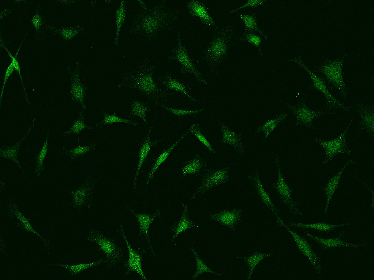 Immunocytochemistry/Immunofluorescence: PSMC6 Antibody [NBP2-99613] - Immunofluorescence staining of PSMC6 in Hela cells. Cells were fixed with 4% PFA, permeabilzed with 0.1% Triton X-100 in PBS, blocked with 10% serum, and incubated with NBP2-99613 antibody (dilution ratio 1:500) at 4C overnight. Then cells were stained with the Alexa Fluor(R)488-conjugated Goat Anti-rabbit IgG secondary antibody (green). Positive staining was localized to cytoplasm and nucleus.