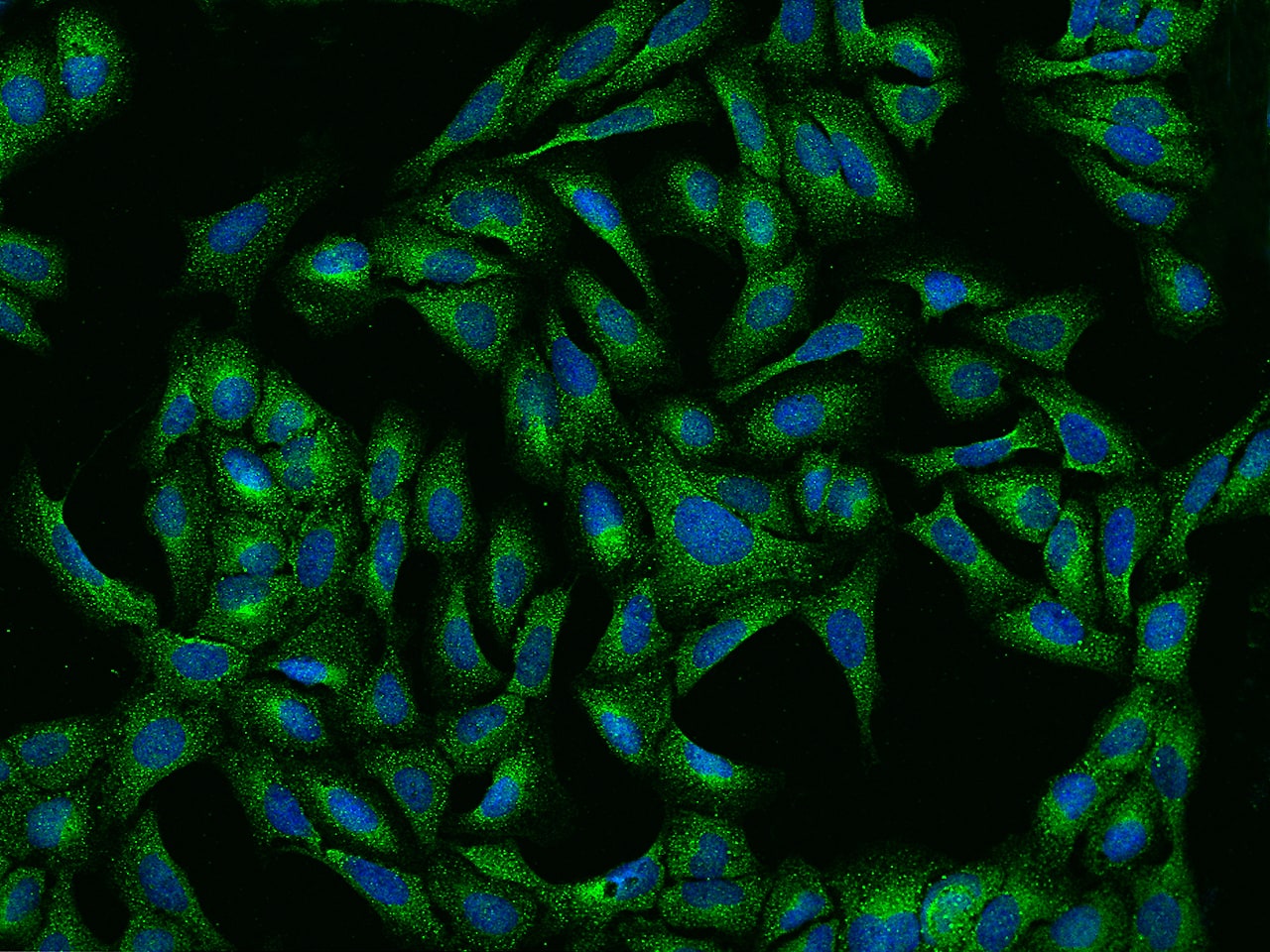 Immunocytochemistry/Immunofluorescence: Ribonuclease Inhibitor Antibody [NBP2-99628] - Immunofluorescence staining of Ribonuclease Inhibitor in U2OS cells. Cells were fixed with 4% PFA, permeabilzed with 0.1% Triton X-100 in PBS, blocked with 10% serum, and incubated with NBP2-99628 antibody (dilution ratio 1:1000) at 4C overnight. Then cells were stained with the Alexa Fluor(R)488-conjugated Goat Anti-rabbit IgG secondary antibody (green) and counterstained with DAPI (blue).Positive staining was localized to Cytoplasm.