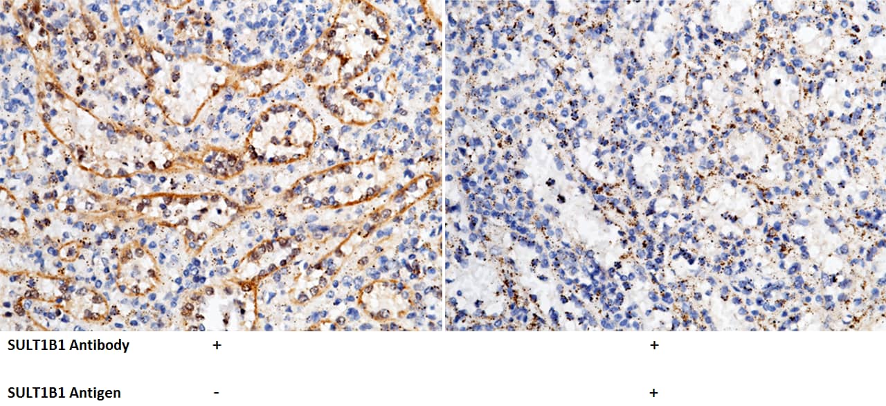 Immunohistochemistry-Paraffin: Cytosolic Sulfotransferase 1B1/Cytosolic Sulfotransferase 1B1/SULT1B1 Antibody [NBP2-99836] - Immunochemical staining of human Cytosolic Sulfotransferase 1B1/SULT1B1 in human spleen with NBP2-99836 (1:1000, formalin-fixed paraffin embedded sections). The left panel: tissue incubated with primary antibody; The right panel: tissue incubated with the mixture of primary antibody and antigen (recombinant protein).