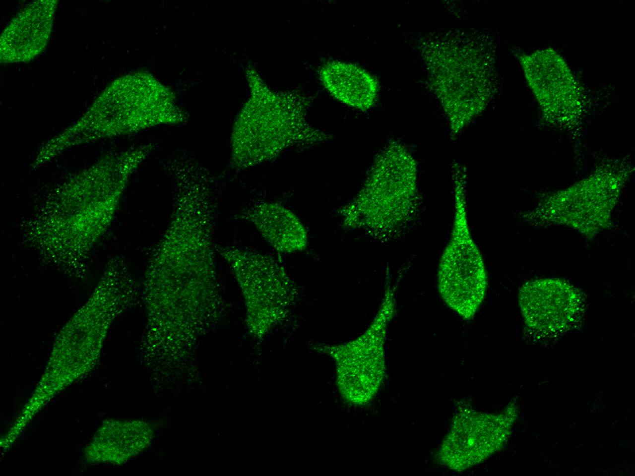 Immunocytochemistry/Immunofluorescence: Protein Kinase D2 Antibody [NBP2-99858] - Immunofluorescence staining of Protein Kinase D2 in Hela cells. Cells were fixed with 4% PFA, permeabilzed with 0.3% Triton X-100 in PBS, blocked with 10% serum, and incubated with NBP2-99858 antibody (dilution ratio 1:1000) at 4C overnight. Then cells were stained with the Alexa Fluor$488-conjugated Goat Anti-rabbit IgG secondary antibody (green). Positive staining was localized to cytoplasm and nucleus.