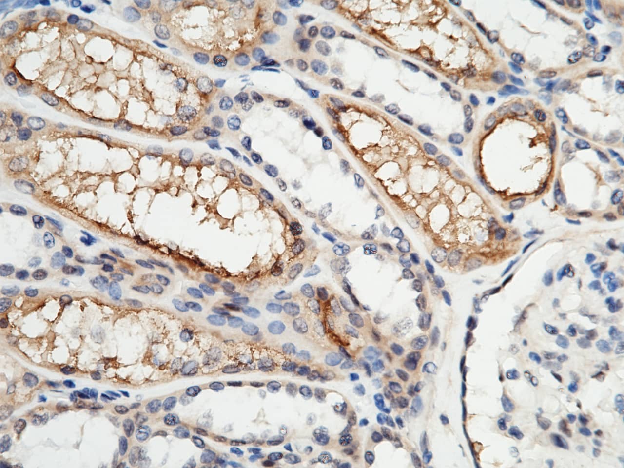 Immunohistochemistry-Paraffin: Aminopeptidase P2/Aminopeptidase P2/XPNPEP2 Antibody [NBP2-99900] - Immunochemical staining of human Aminopeptidase P2/XPNPEP2 in human kidney with NBP2-99900 (1:1000, formalin-fixed paraffin embedded sections).