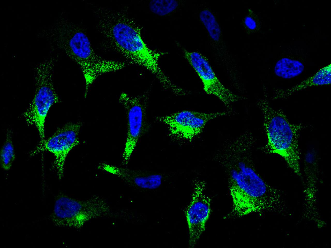 Immunocytochemistry/Immunofluorescence: CaMKV Antibody [NBP2-99963] - Immunofluorescence staining of CaMKV in HeLa cells. Cells were fixed with 4% PFA, permeabilzed with 0.3% Triton X-100 in PBS, blocked with 10% serum, and incubated with NBP2-99963 antibody (1:1000) at 4C overnight. Then cells were stained with the Alexa Fluor(R)488-conjugated Goat Anti-rabbit IgG secondary antibody (green) and counterstained with DAPI (blue). Positive staining was localized to cytoplasm.