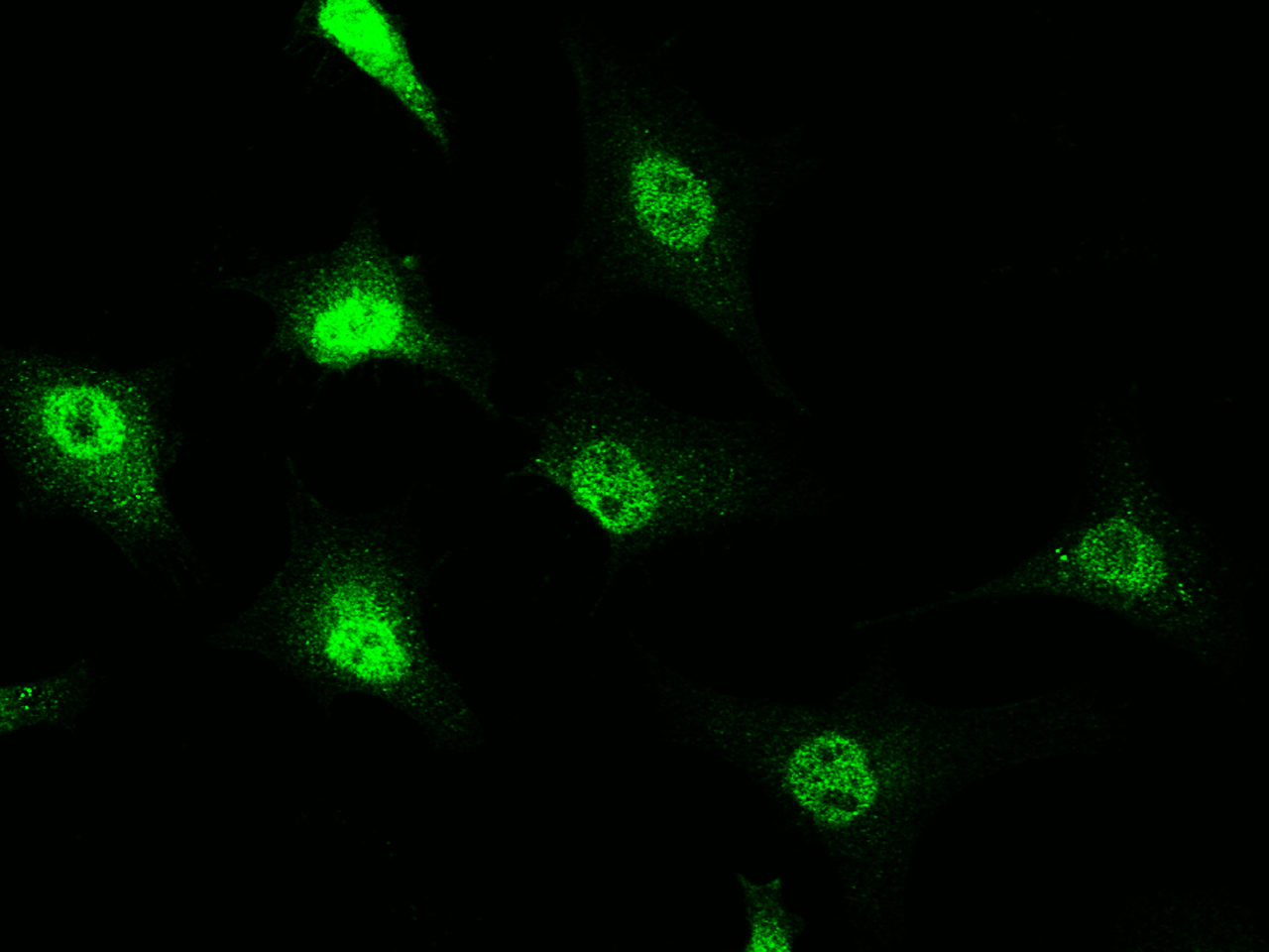 Immunocytochemistry/Immunofluorescence: RAIDD/CRADD Antibody [NBP3-00051] - Immunofluorescence staining of RAIDD/CRADD in HeLa cells. Cells were fixed with 4% PFA, permeabilzed with 0.3% Triton X-100 in PBS, blocked with 10% serum, and incubated with NBP3-00051 antibody (1:5000) at 4C overnight. Then cells were stained with the Alexa Fluor(R)488-conjugated Goat Anti-rabbit IgG Secondary antibody (green).Positive staining was localized to cytoplasm and nucleus.