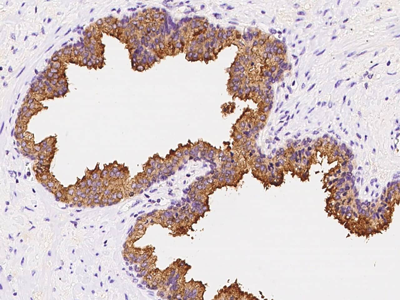 Immunohistochemistry-Paraffin: ZAG Antibody [NBP3-00103] - Immunochemical staining of human ZAG in human prostate with NBP3-00103 at 1:5000 dilution, formalin-fixed paraffin embedded sections.