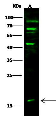 Western Blot: GMF-beta Antibody [NBP3-00104] - NBP3-00104 at 1:500 dilution Lane A: Jurkat Whole Cell Lysate Lysates/proteins at 30 ug per lane. Secondary Goat Anti-Rabbit IgG H&L (Dylight800) at 1/10000 dilution. Developed using the Odyssey technique. Performed under reducing conditions. Predicted band size:17 kDa Observed band size:17 kDa (We are unsure as to the identity of these extra bands.) 