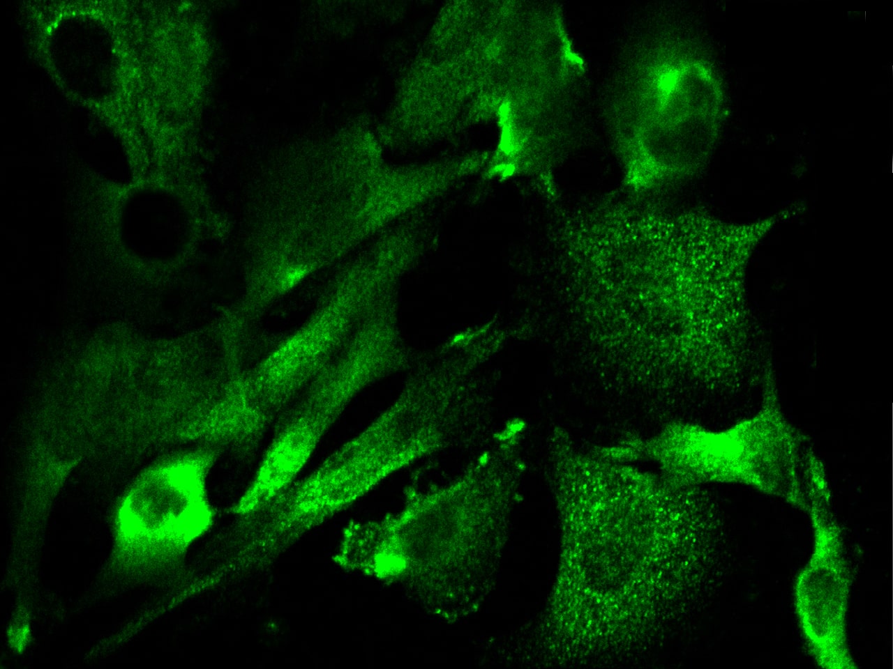 Immunocytochemistry/ Immunofluorescence: GM2A Antibody [NBP3-00105] - Immunofluorescence staining of GM2A in U251MG cells. Cells were fixed with 4% PFA, permeabilzed with 0.3% Triton X-100 in PBS,blocked with 10% serum, and incubated with NBP3-00105 (dilution ratio 1:1000) at 4 overnight. Then cells were stained with the Alexa Fluor$488-conjugated Goat Anti-rabbit IgG secondary antibody (green). Positive staining was localized to cytoplasm.