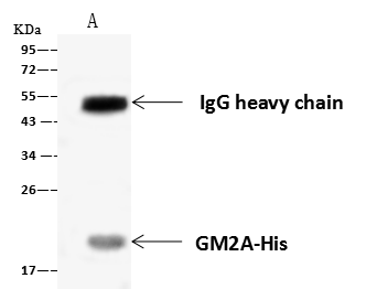 Immunoprecipitation: GM2A Antibody [NBP3-00106] - GM2A was immunoprecipitated using: Lane A:0.5 mg HeLa Whole Cell Lysate 4 uL NBP3-00106 and 60 ug of Immunomagnetic beads Protein A/G. Primary antibody: NBP3-00106, at 1:100 dilution. Secondary antibody: Goat Anti-Rabbit IgG (H+L)[HRP] at 1/10000 dilution. Developed using the ECL technique. Performed under reducing conditions. Predicted band size: 21 kDa Observed band size :21 kDa 