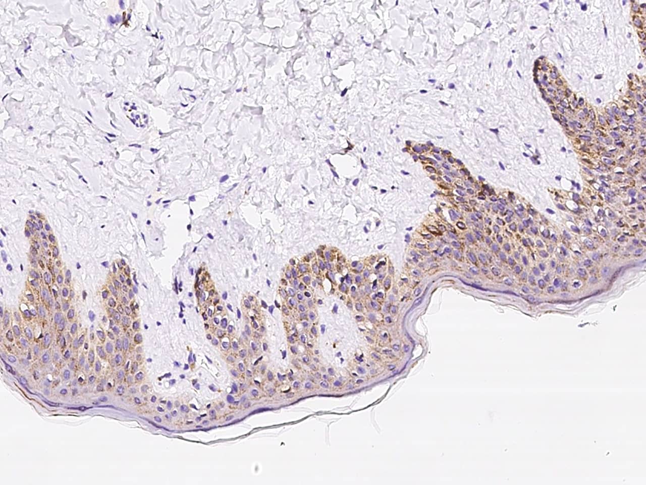 Immunohistochemistry-Paraffin: GM2A Antibody [NBP3-00106] - Immunochemical staining of human GM2A in human skin with NBP3-00106 at 1:1000 dilution, formalin-fixed paraffin embedded sections.