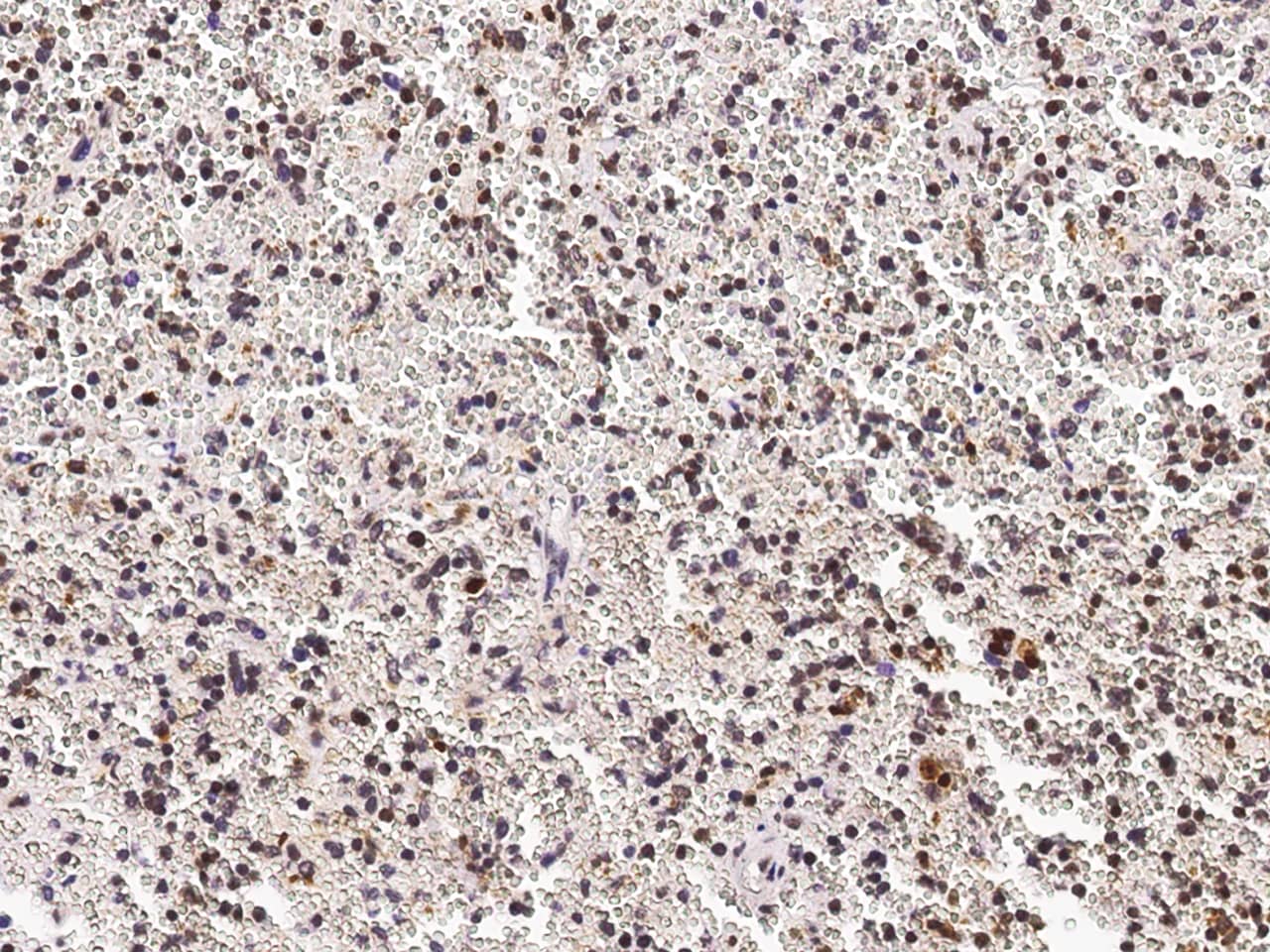 Immunohistochemistry-Paraffin PHYH Antibody - Azide and BSA Free