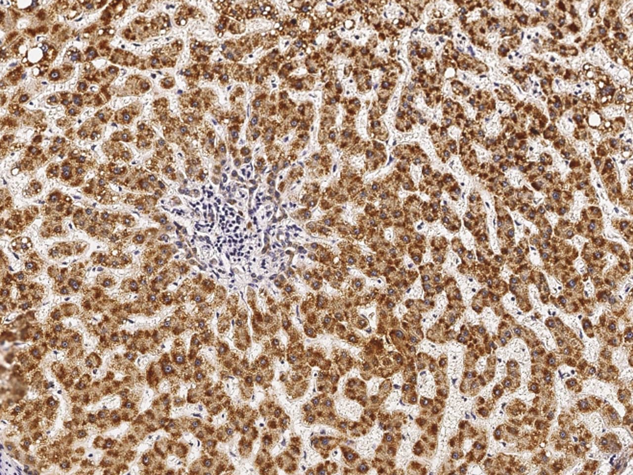 Immunohistochemistry-Paraffin PHYH Antibody - Azide and BSA Free