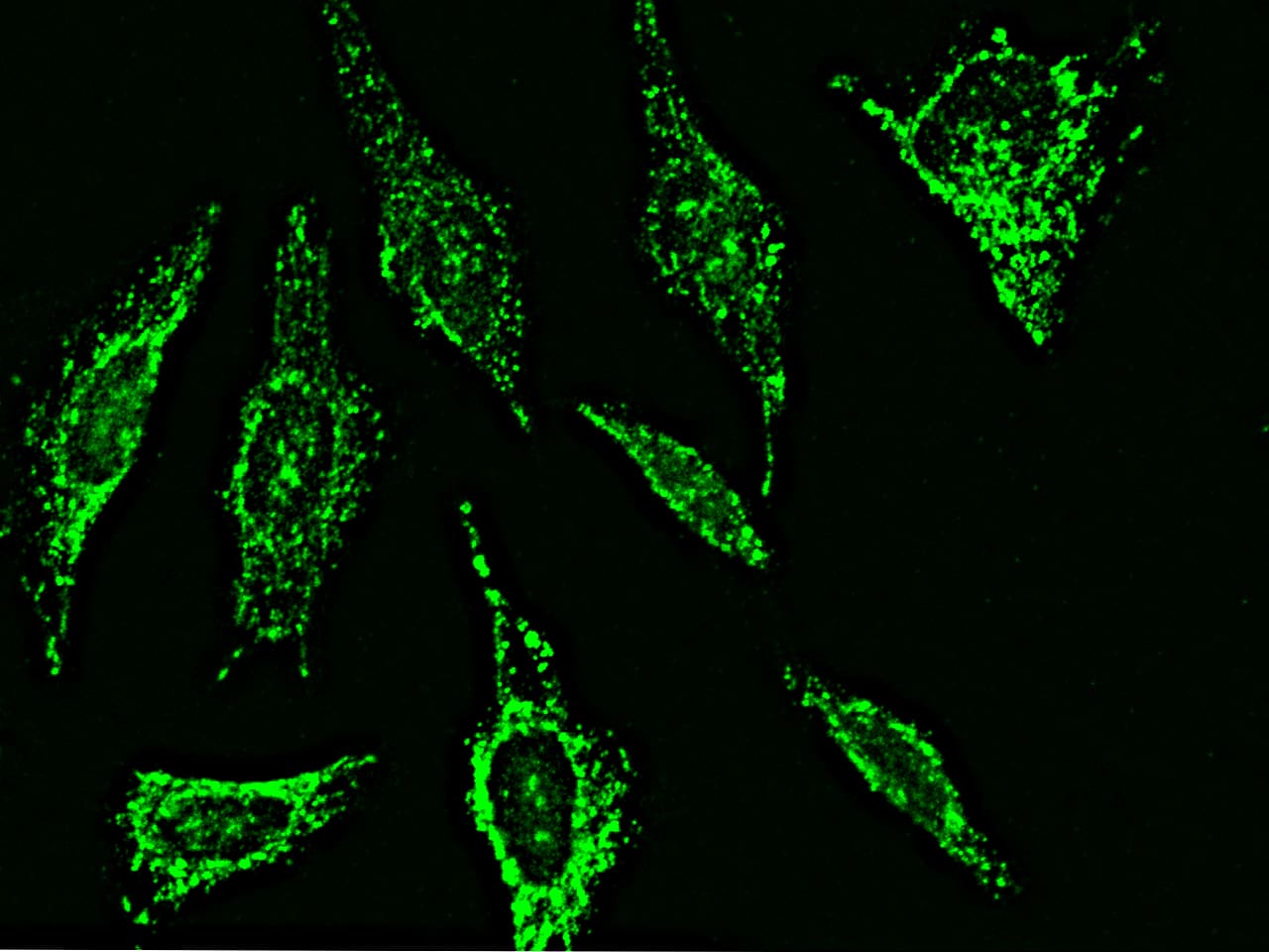 Immunocytochemistry/ Immunofluorescence: MMP26 Antibody [NBP3-00124] - Immunofluorescence staining of MMP26 in Hela cells. Cells were fixed with 4% PFA, permeabilzed with 0.3% Triton X-100 in PBS,blocked with 10% serum, and incubated with NBP3-00124 (dilution ratio: 1:1000) at 4 overnight. Then cells were stained with the Alexa Fluor488-conjugated Goat Anti-rabbit IgG secondary antibody (green)Positive staining was localized to cytoplasm.