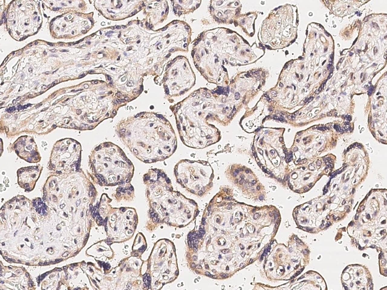 Immunohistochemistry-Paraffin: MMP26 Antibody [NBP3-00124] - Immunochemical staining of human MMP26 in human placenta with NBP3-00124 at 1:500 dilution, formalin-fixed paraffin embedded sections.