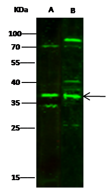 Western Blot: MBD3 Antibody [NBP3-00136] - NBP3-00136 at 1:500 dilution Lane A: Jurkat Whole Cell Lysate Lane B: 293T Whole Cell Lysate Lysates/proteins at 30 ug per lane. Secondary Goat Anti-Rabbit IgG H&L (Dylight800) at 1/10000 dilution. Developed using the Odyssey technique. Performed under reducing conditions. Predicted band size:33 kDa Observed band size:37 kDa (We are unsure as to the identity of these extra bands.) 