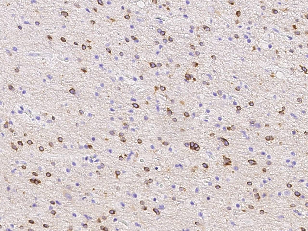 Immunohistochemistry-Paraffin: PDE1C Antibody [NBP3-00157] - Immunochemical staining of human PDE1C in human brain with NBP3-00157 (1:2000, formalin-fixed paraffin embedded sections).